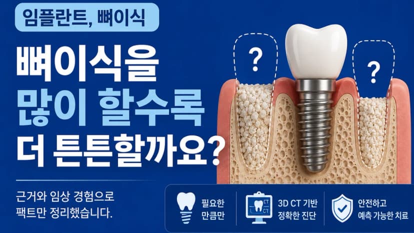 임플란트, 뼈이식을 많이 할수록 더 튼튼해질까요? 대표 이미지