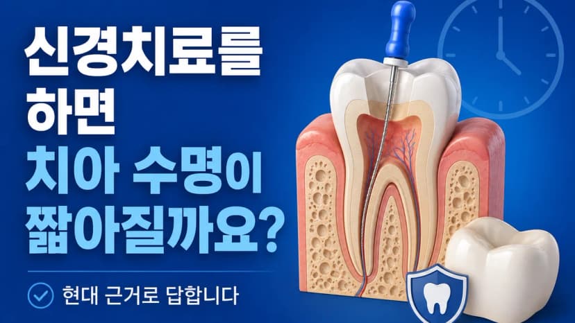 신경치료를 하면 치아 수명이 정말 짧아질까요? 대표 이미지