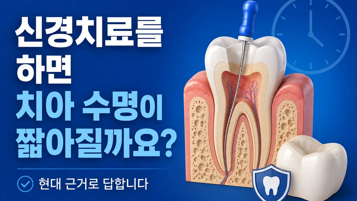 신경치료를 하면 치아 수명이 정말 짧아질까요? 대표 이미지